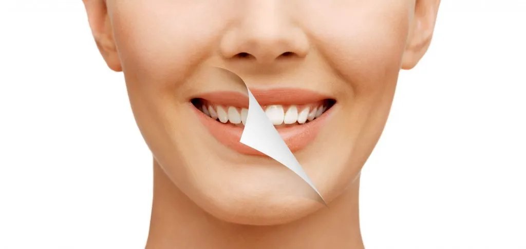 a teeth whitening before and after